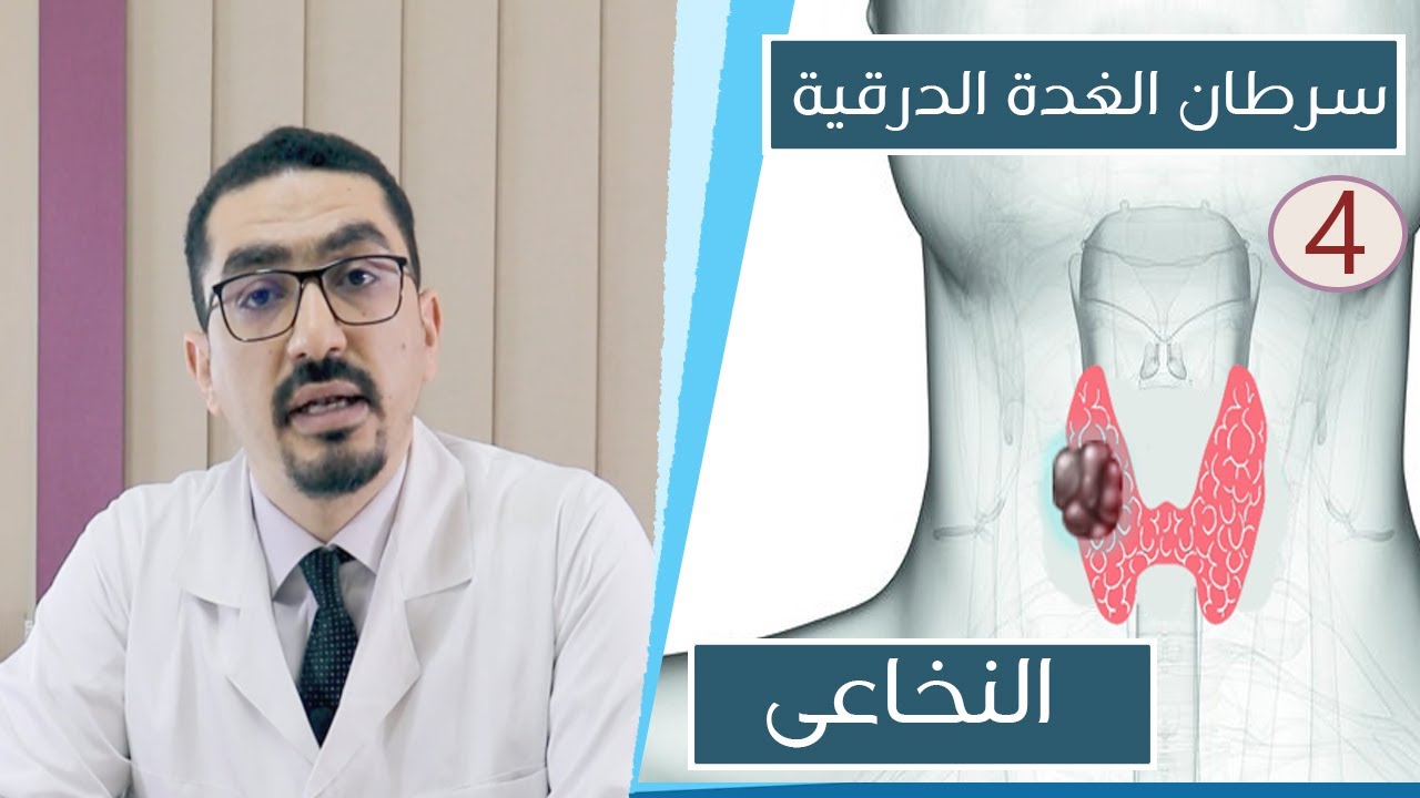 علاج سرطان الغدة الدرقية النخاعى وأنواع الجراحة