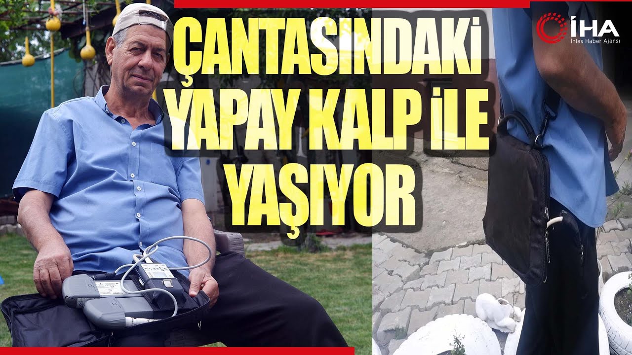 Çantasında Taşıdığı Yapay Kalp Cihazıyla Hayatını Sürdürüyor