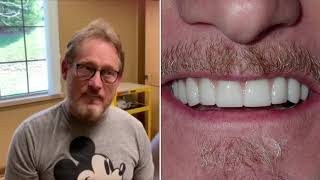Teeth Now Buffalo Testimonial