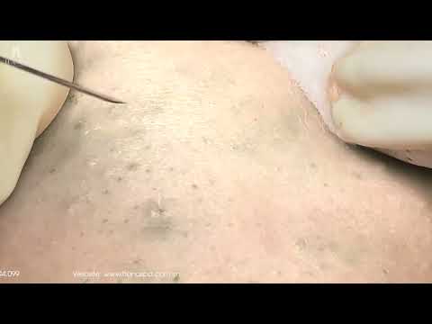 Instant Hard Male Enhancement [6bWIXVYyTs]