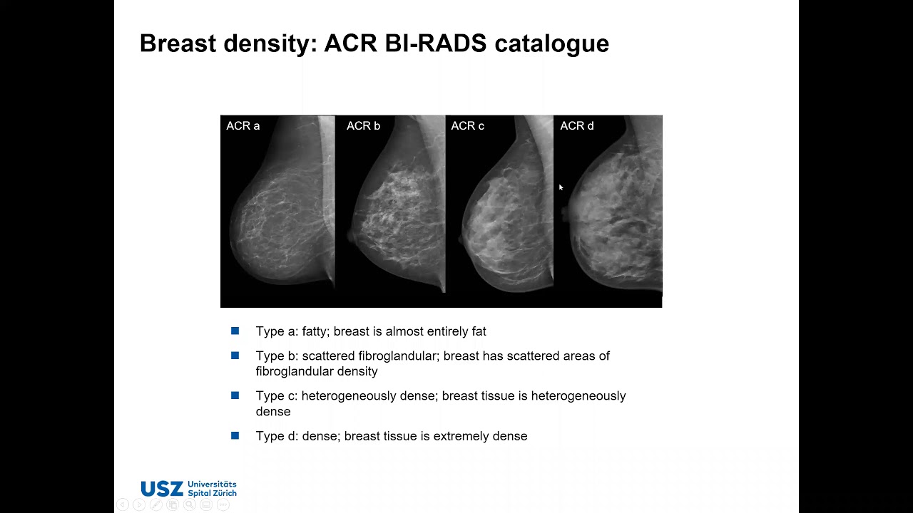 WEBINAR 26 From Idea to Product AI Based Applications in Radiological