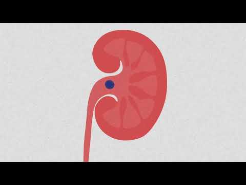 Как проверить почки, какие анализы надо сдавать?