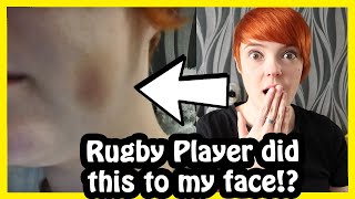 Rugby Player did this TO MY FACE!? Storytime vlog