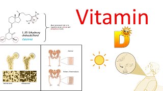 Vitamin D and its deficiency associated disease (Ricket & Osteomalacia)