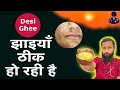 Desi ghee for pigmentation  desi ghee is best for pigmentation  dr prateek chauhan