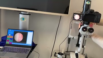 Digital SLR camera used in operating room. (Digitalization slit lamps and operating microscopes)