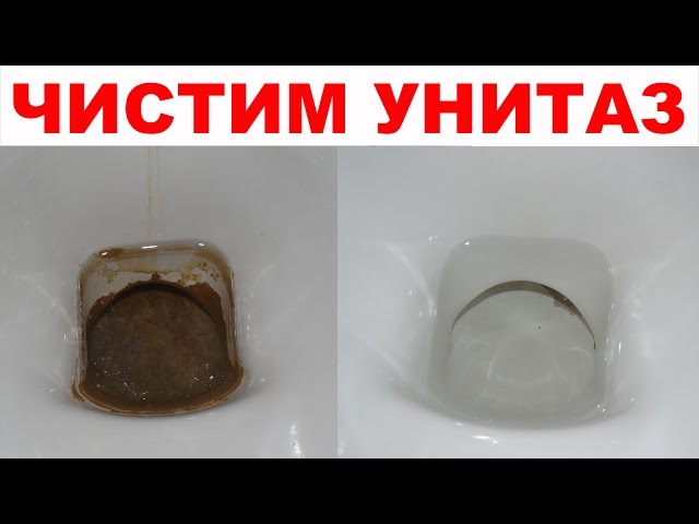 Как убрать мочевой камень в колене унитаза