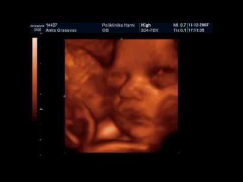Video: 28 Tjedana Trudnoće: Senzacije, Razvoj Fetusa