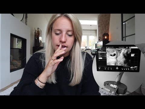 Video: Mijn vriendin is zwanger: hoe bewaar ik deze relatie?