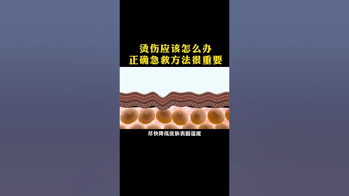 你有被热水烫伤过吗，你知道正确的处理方法吗 - 天天要闻