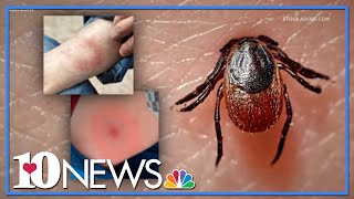 Man discusses his experience with Lyme Disease as tick season gets closer