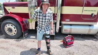 I SHATTERED My Knee!