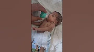 محاولة بدء الرضاعة للطفل الذي مولود في الشهر السادس 