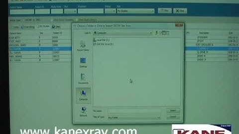 echoes_IMPORT DICOM.avi