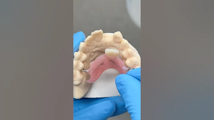 Metal Clasped Flipper Partial @EnvisiontecMain #envisiontec #lsk121shorts #dentist #teeth