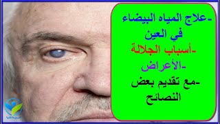 علاج المياه البيضاء بالعين أو الجلالة : الأعراض,طرق التشخيص | الموسوعة الطبية