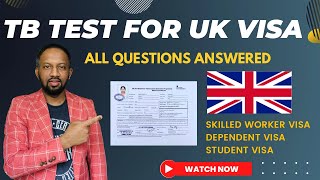TB Test For UK Visa Complete Process Explained | All Questions Answered | How and When to do TB test
