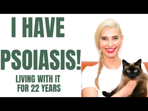 Video: 3 måter å ta vare på psoriasis