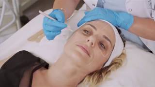 How to treat a patient with Tixel 2 ?