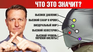 Реальная причина метаболического синдрома. Откажитесь от этого🙌