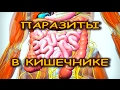 КИШЕЧНИК СТРАДАЕТ ОТ ПАРАЗИТОВ? Удалите их с помощью натуральных продуктов