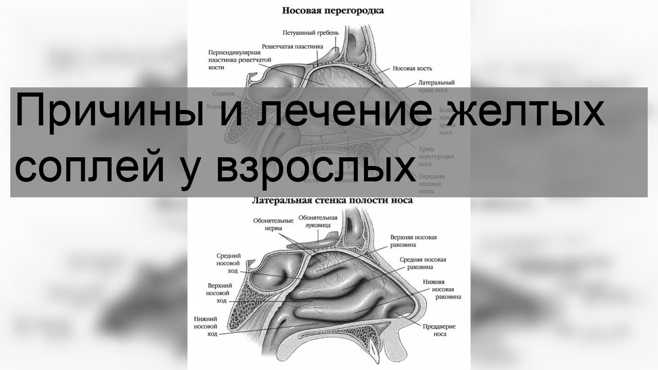 Как отличить сопли