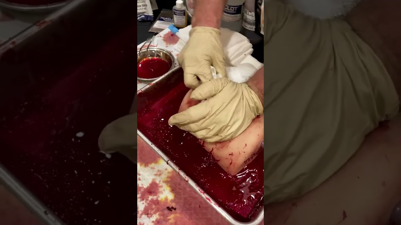This is gross! But it could save your life… #trauma #medical #doctor #emergency #safety #combat
