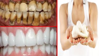 تحويل الأسنان الصفراء المتسخة إلى أسنان بيضاء في دقيقتين فقط (عرض حي)