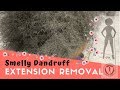 Smelly Dandruff Extension Removal