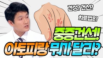 빠르면 빠를 수록 좋은 건선 치료!?‍⚕️ 