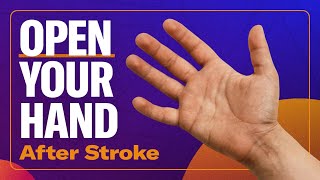 Why Your Hand Wont Open After Stroke How To Fix It