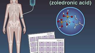 Zoledronate In Osteopenia