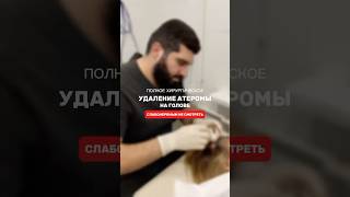 #атерома #жировик #хирург #операция #здоровье