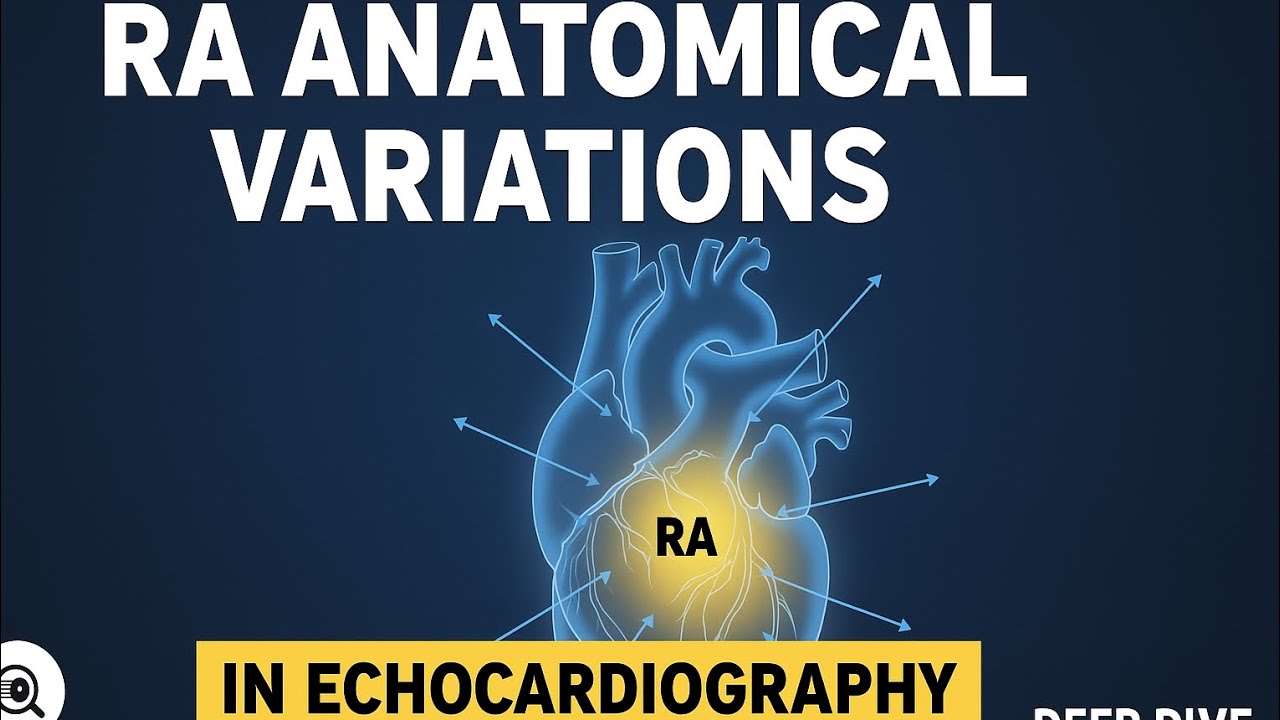 RA Anatomical Variations in Echocardiography 