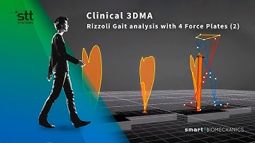 Rizzoli Gait analysis protocol with 4 Force Plates in Clinical 3DMA (2)