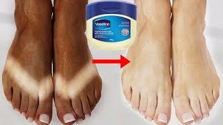 How To Remove Sun Tan Using Vaseline | Sun Tan Removal Home Remedies | 100% Effective
