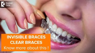 INVISIBLE BRACES – Latest Trend | Pros & Cons of Clear Aligners Dr. Lahari A.S.R | Doctors' Circle