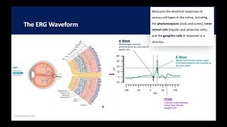 Dr. Pamela Weber—Predicting Vision Loss in a Busy Retina Practice