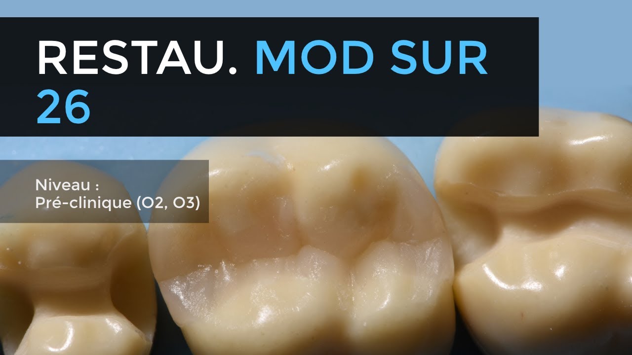 106 - Restauration MOD en résine composite sur 26