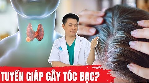 Tóc Bạc Ở Người Trẻ – Tuyến Giáp Có Phải Là Nguyên Nhân? Bác Sĩ Chiều