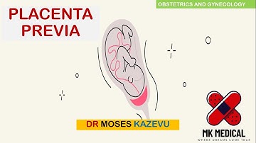 Placenta Previa