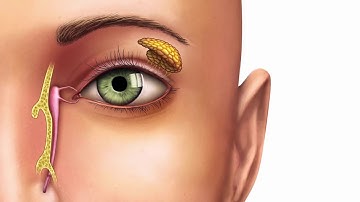 About AXION® MSR   EyeFace Wash Technology