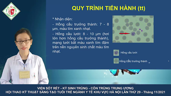 Hồng cầu lưới ký hiệu là gì năm 2024