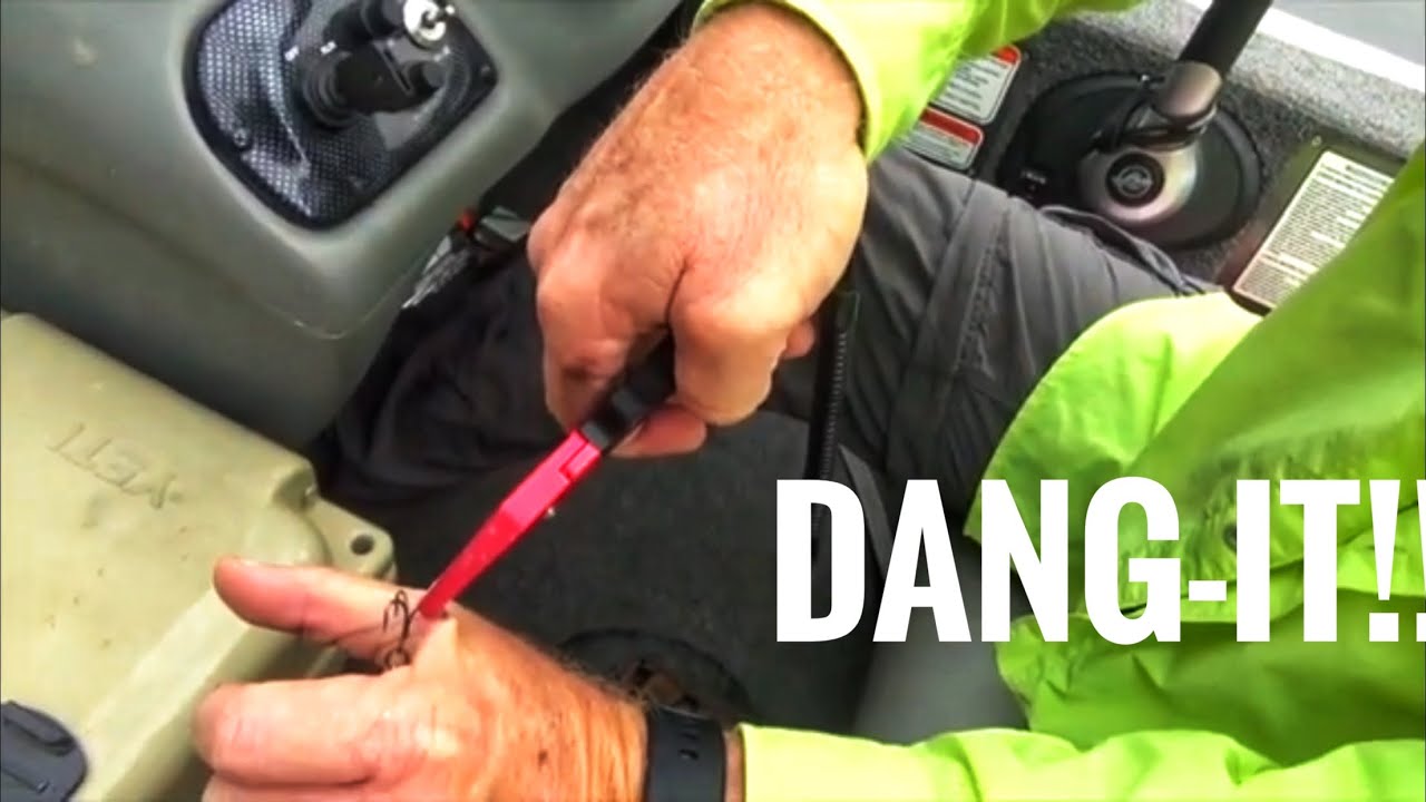 I got a fishhook in my hand! 