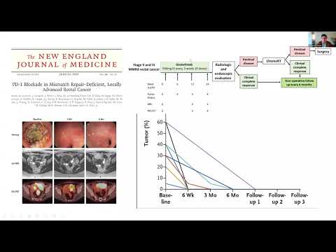 ROVER  Neoadjuvant Strategies for Rectal Cancer