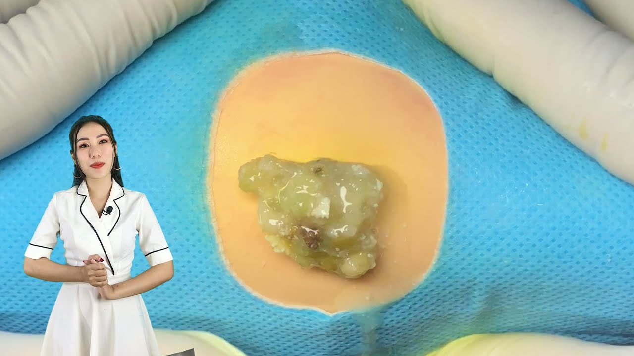 DIY Massage Cream for Spotless ,Smooth,Tight and Loss Treatments Apathy