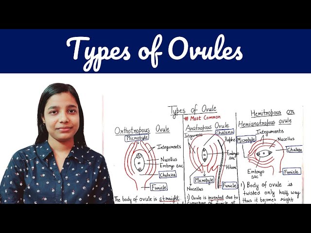 types of ovules | types of ovules class XII , B.Sc. , M.Sc. | By Jyoti Verma class=