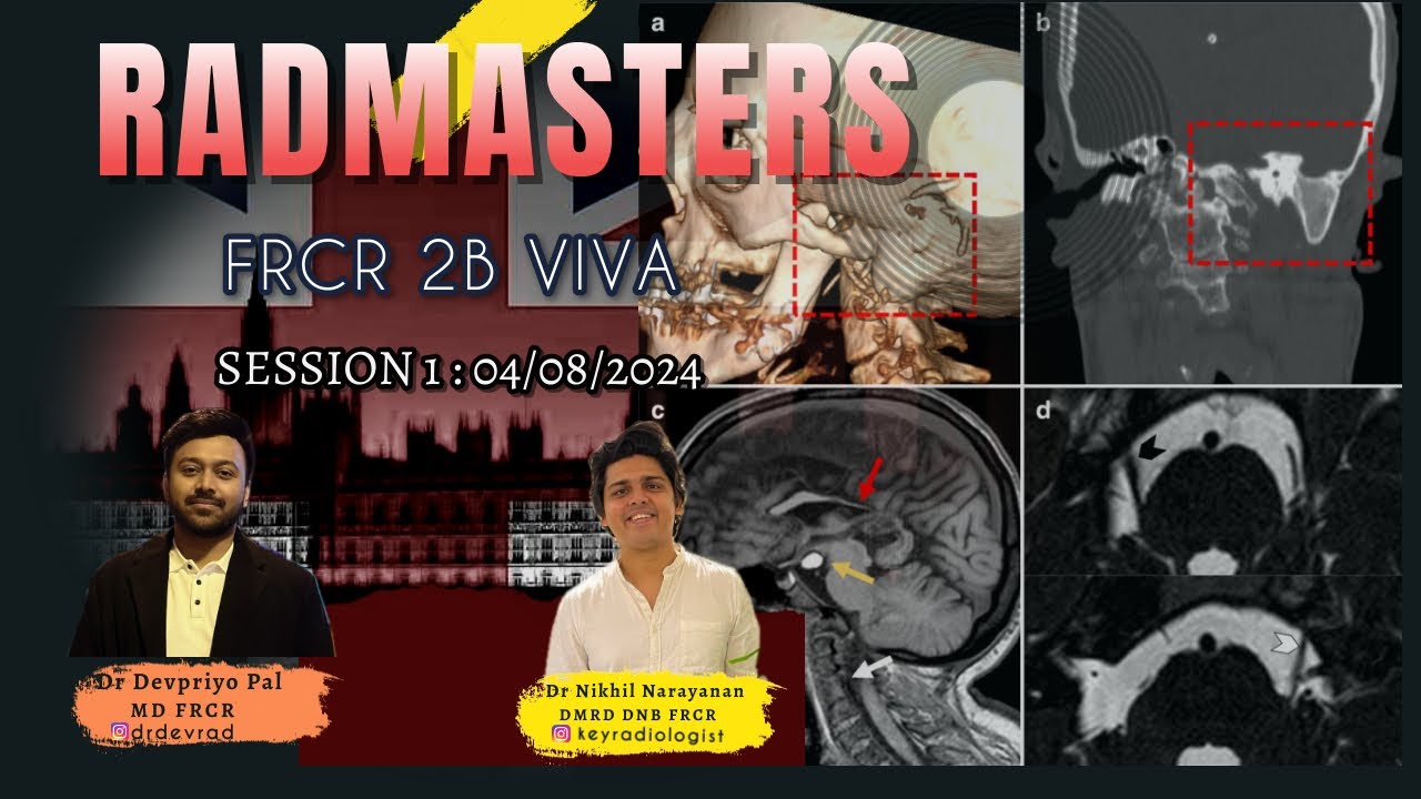 RAD MASTERS FRCR 2B VIVA SESSION : 1 - YouTube