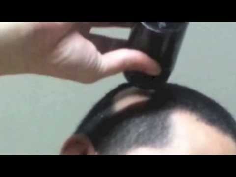 Alopecia Areata Bald Spot for Male: How to Hide Bald Spot with Hair Fibers