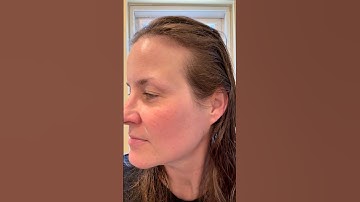 Day 9 using the Shark Ninja CryoGlow Face Mask-my skin is evening out and it feels so soft & smooth!